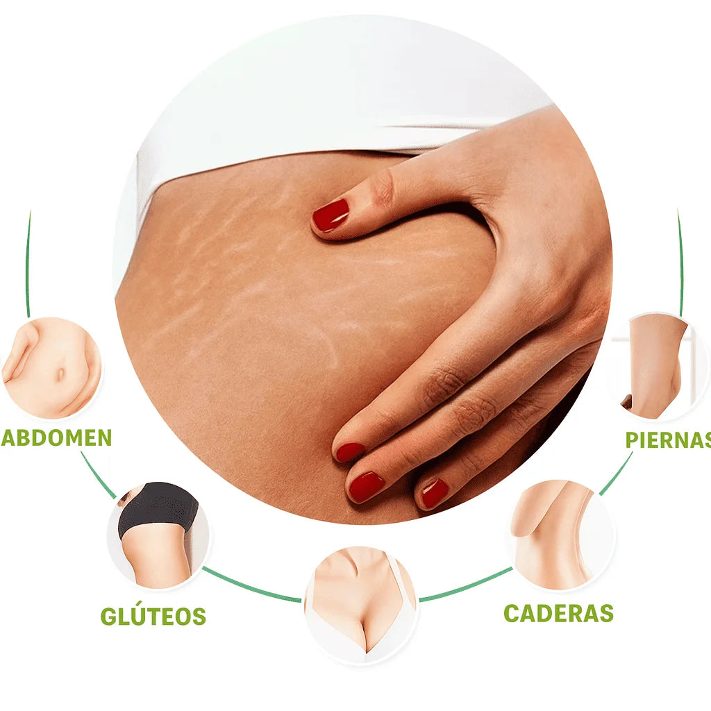 CREMA ANTIESTRÍAS SKINREPAIR
